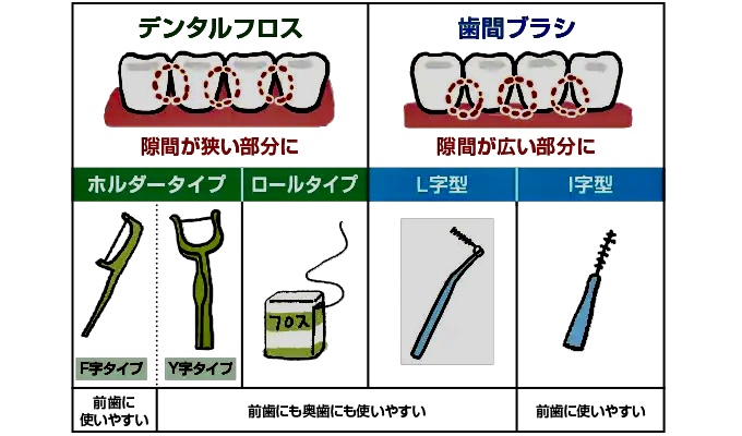 デンタルフロス 歯間ブラシの使い方